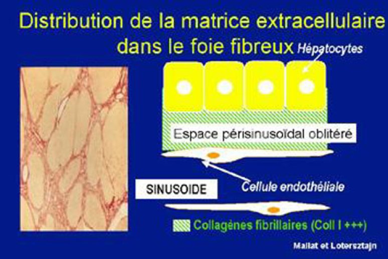 Fig 5 Matrice extracellulaire du foie fibreux