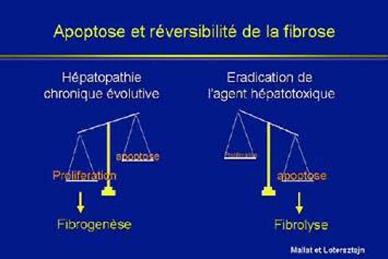 Fig 14 Apoptose et fibrose