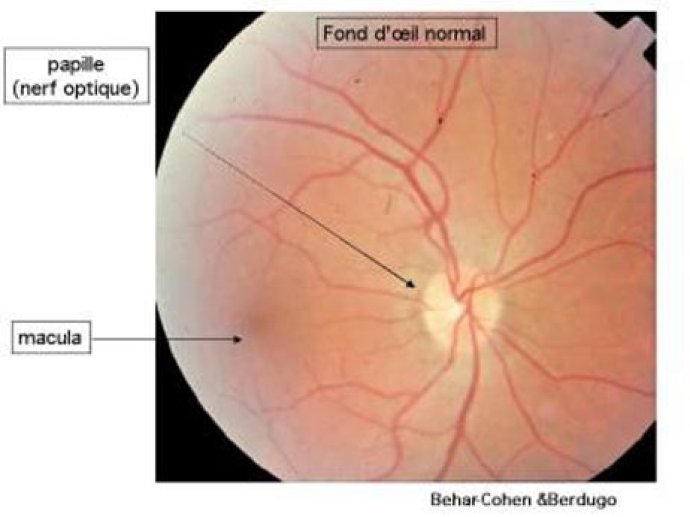 FOND D'OEIL NORMAL