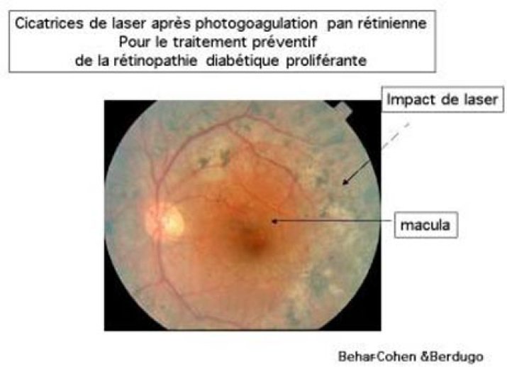 DU LASER à la CHIRURGIE