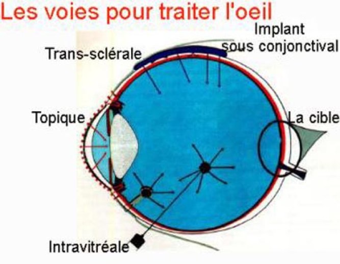 INJECTIONS et IONTOPHORESE