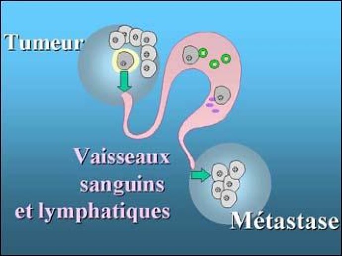 Les métastases des cancers, aspects biologiques