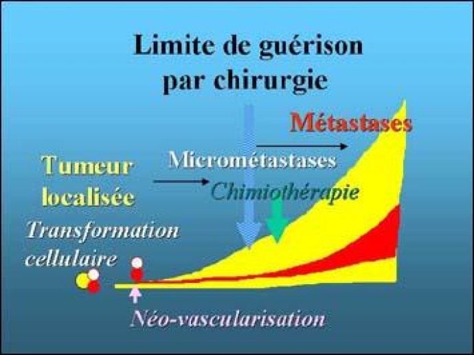 Limite de guérison (suite)