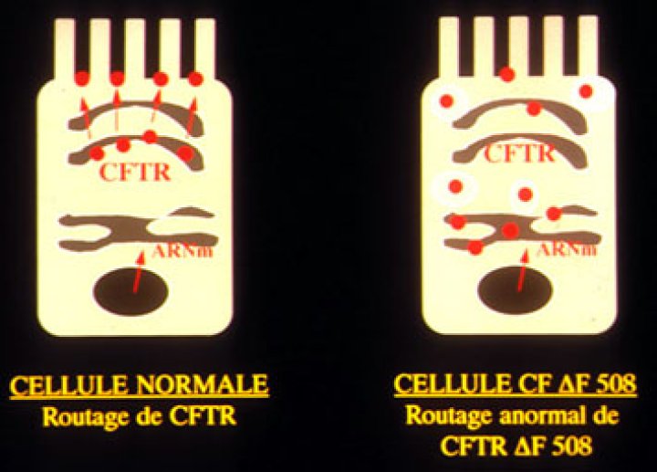 Les mutations du gène CFTR