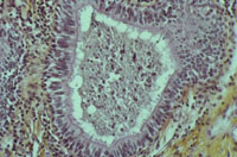 Histologie de l'épithélium respiratoire (suite)