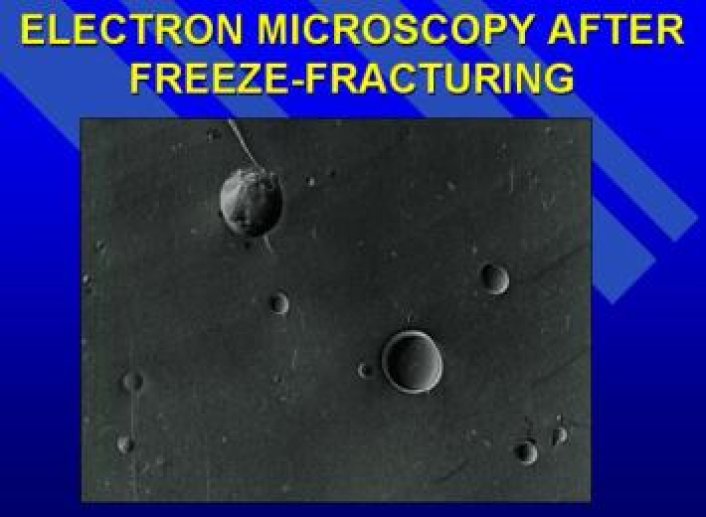 Cryofractures des nanocapsules à contenu aqueux.