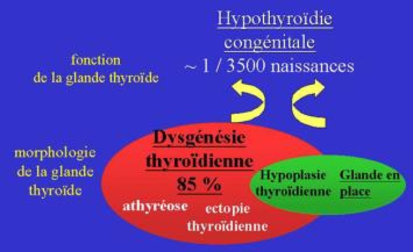 Les différents types d'hypothyroïdie congénitale, insuffisance de fonctionnement de la glande thyroïde détectable dès la naissance.