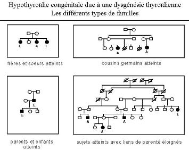 Les familles avec dysgénésie thyroïdienne de type