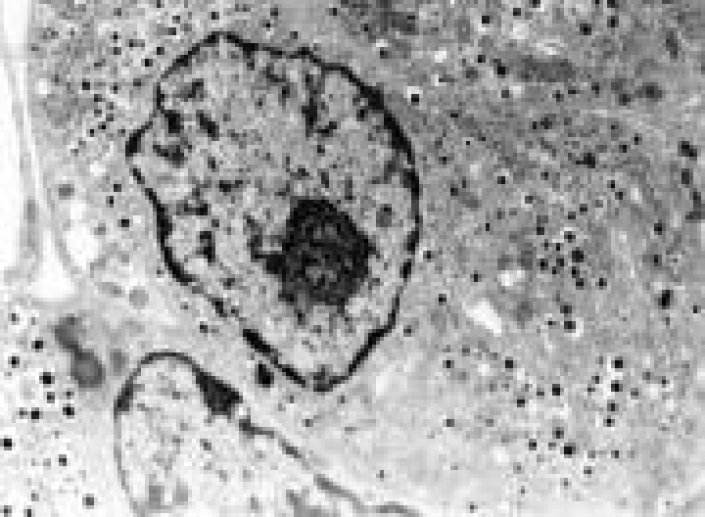 Micrographie de la cellule B insulaire pancréatique vue au microscope électronique (A. Astesano)