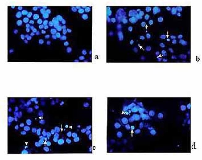 Mort cellulaire programmée ou apoptose