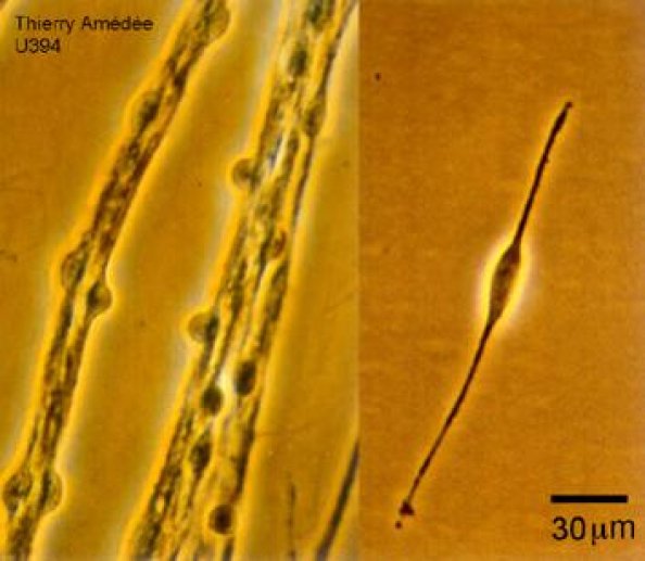 Cellules de Schwann isolées ou en contact avec l'axone