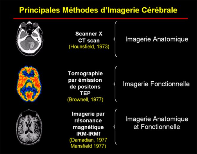 Principales méthodes d'imagerie cérébrale