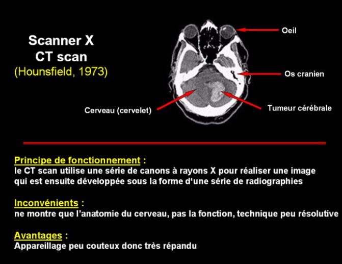 Scanner