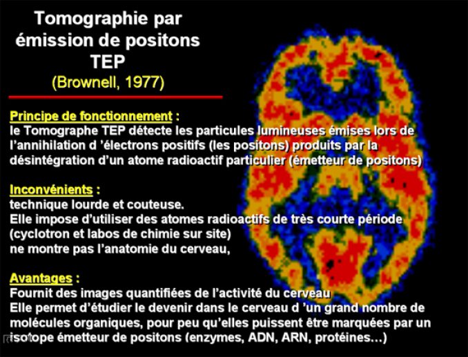 TEP principe de fonctionnement