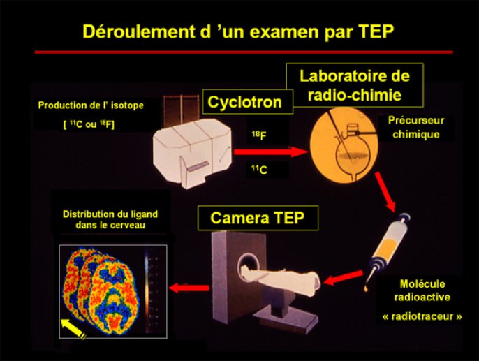 Déroulement d'un examen par TEP