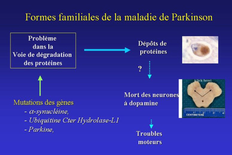 Formes familiales de la maladie