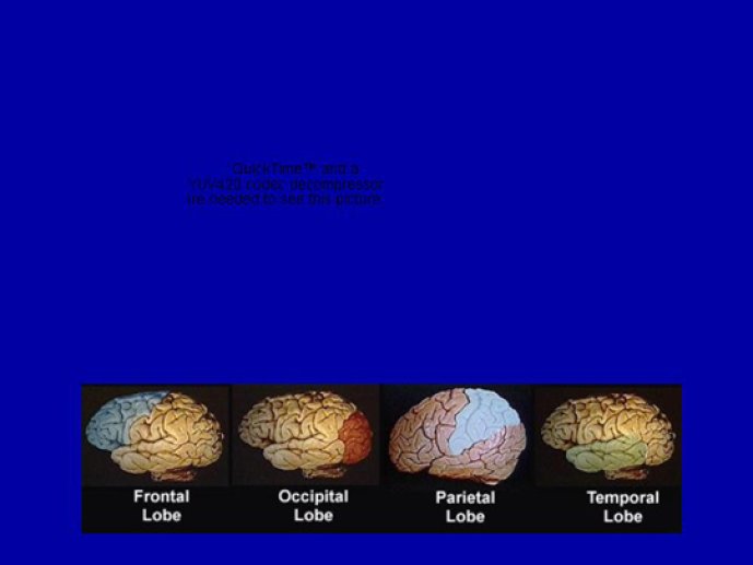 Différentes vues du cerveau humain