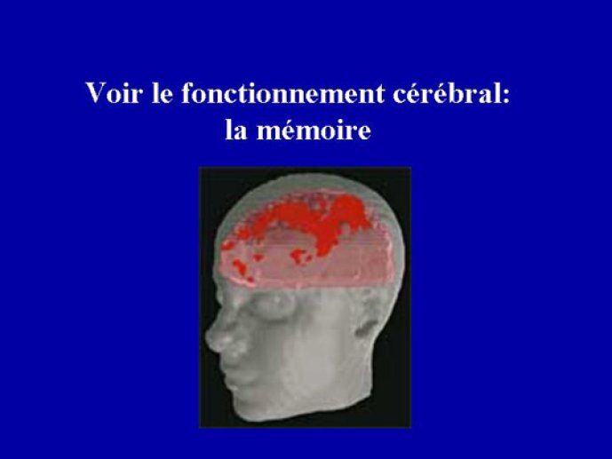 Localisation de la mémoire visuelle