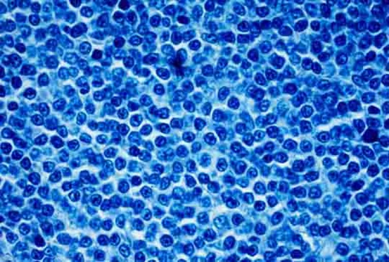 Lymphocytes colorés au bleu trypan