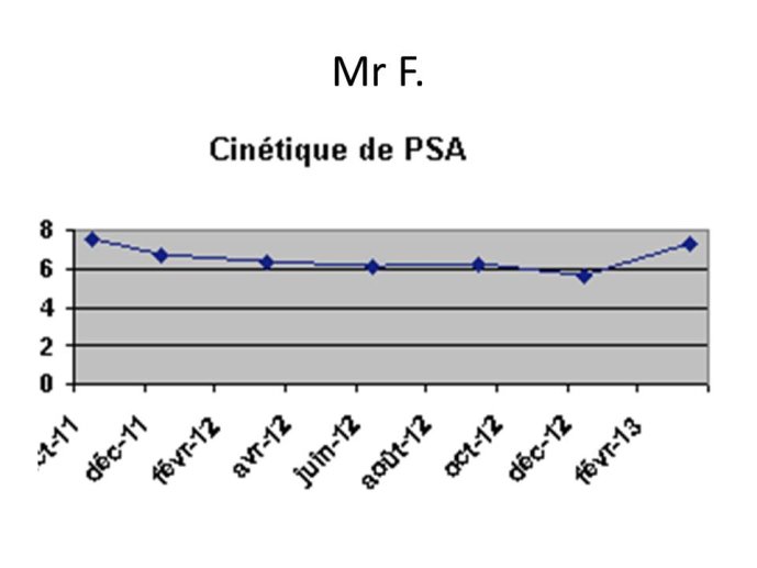 cinétique