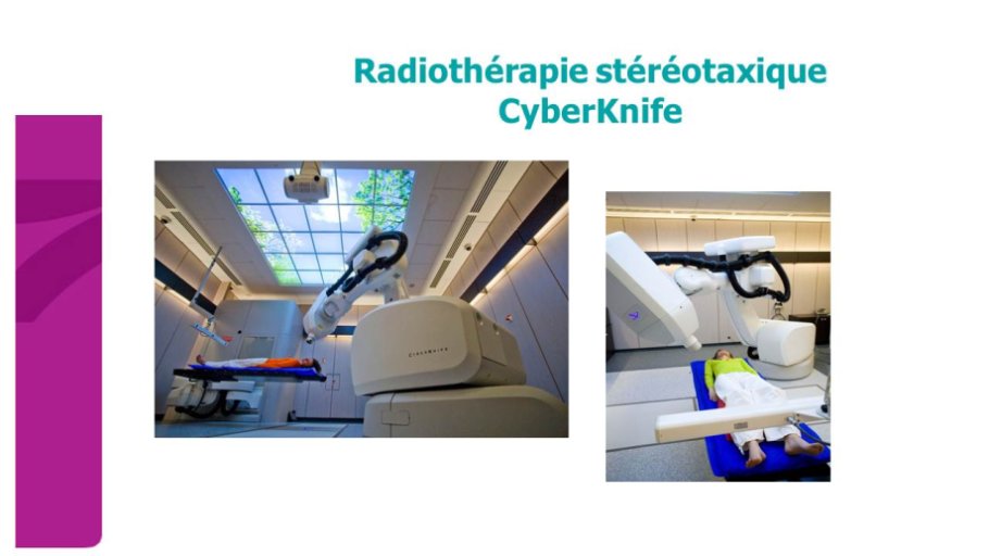 Cyberknife