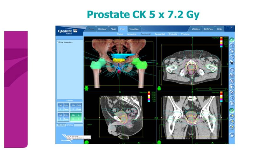 Prostate Image