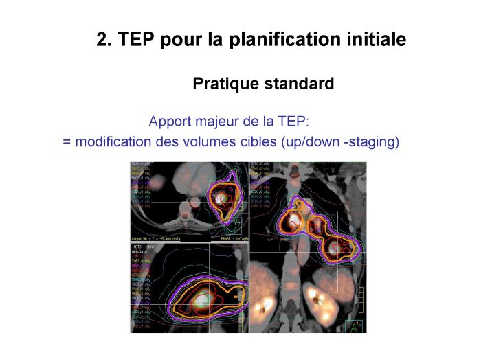 fusion images crevoisier lille 2015 pour pdf_Page_23.jpg