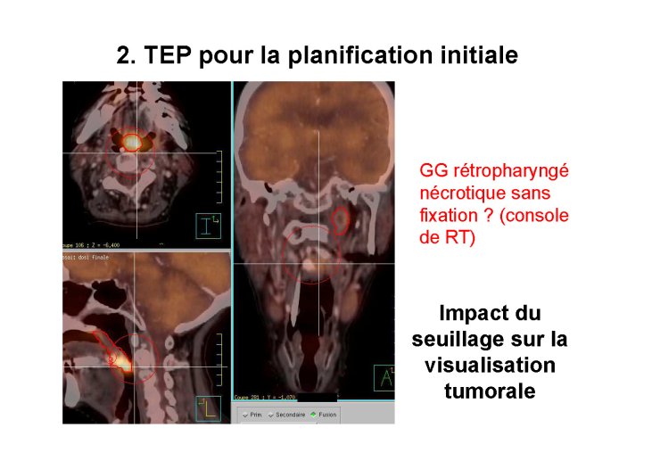 fusion images crevoisier lille 2015 pour pdf_Page_30.jpg