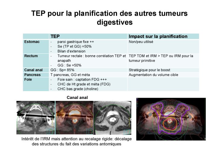 fusion images crevoisier lille 2015 pour pdf_Page_33.jpg