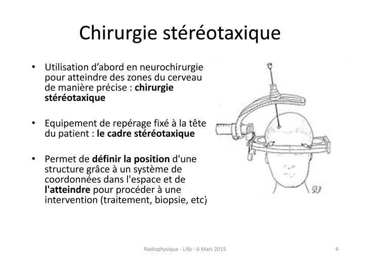 Stéréotaxie_SFjRO_2015 JOSSET_Page_04.jpg
