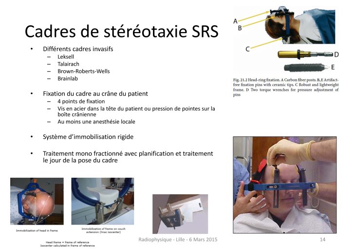 Stéréotaxie_SFjRO_2015 JOSSET_Page_14.jpg