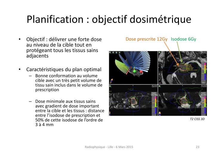 Stéréotaxie_SFjRO_2015 JOSSET_Page_23.jpg