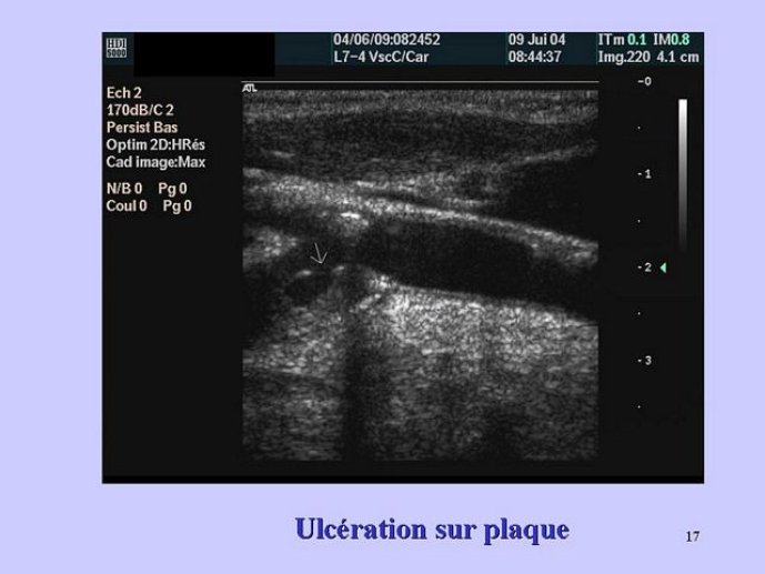 Échographie diagnostique - POSTDIPLÔME - Collège Boréal