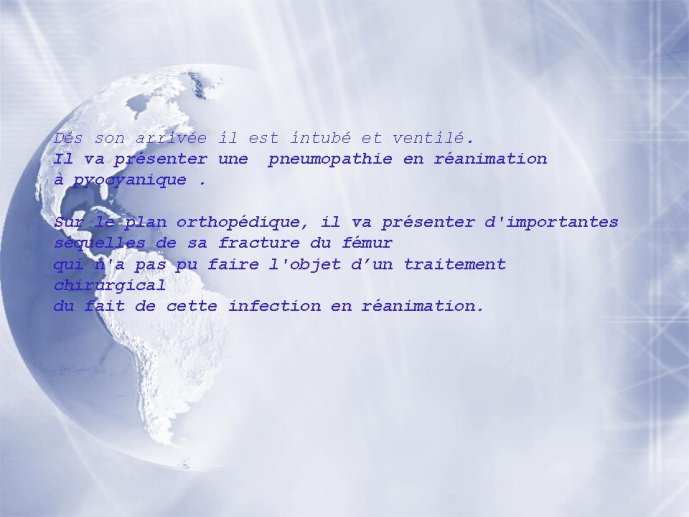 Diapositive7
