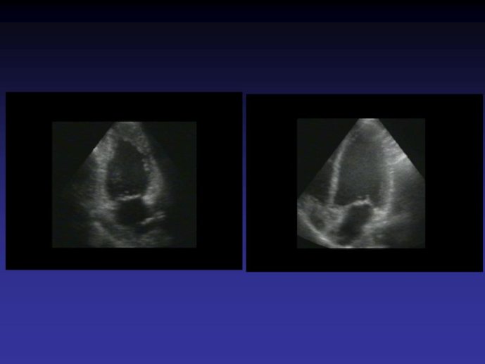 Diapositive9