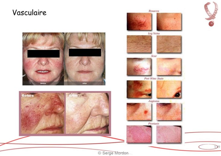 Diapositive119.JPG