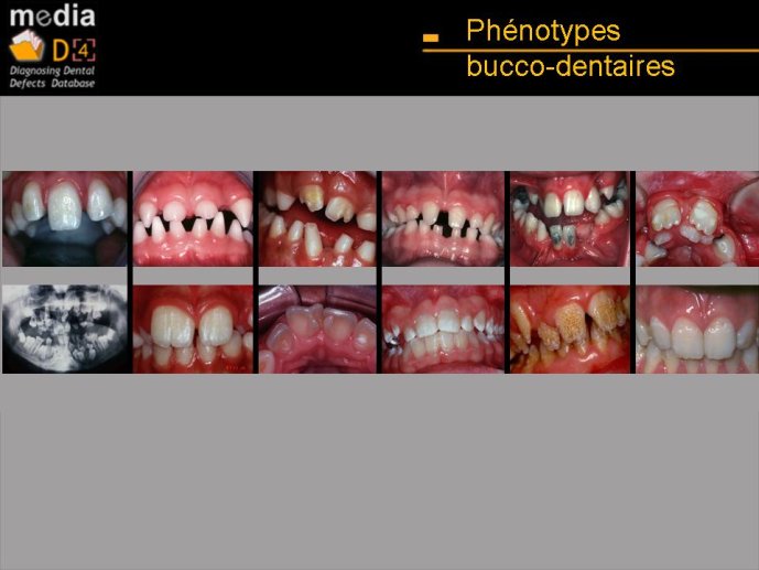 Diapositive3