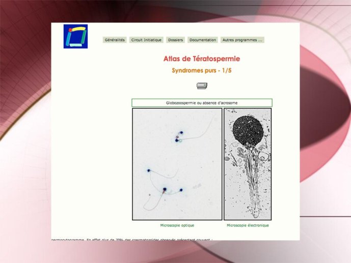 Diapositive9