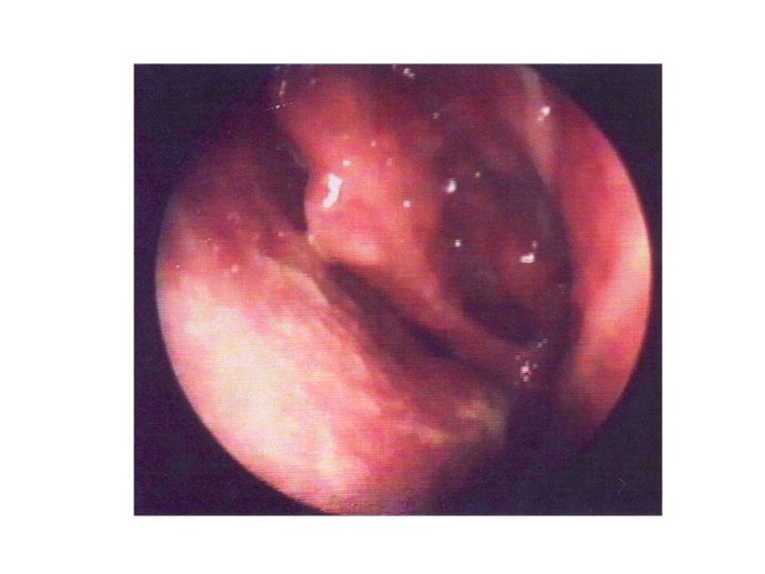 Diapositive33