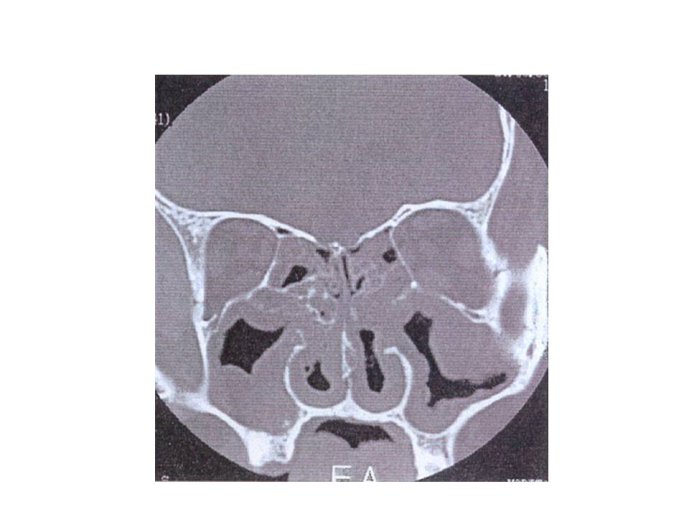 Diapositive34