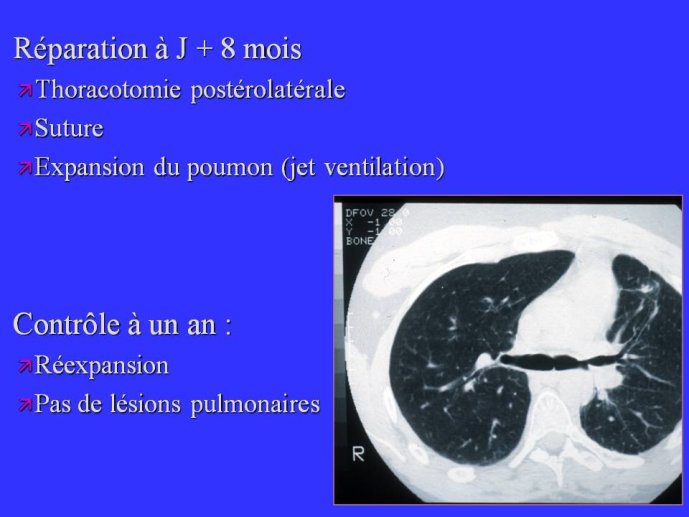 Diapositive57