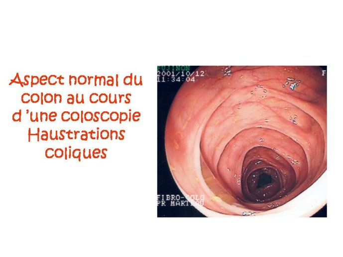 Diapositive3