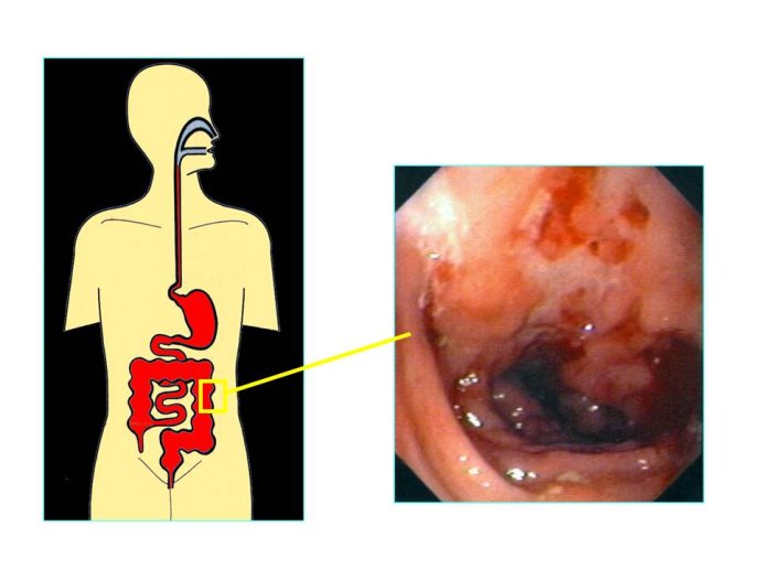 Diapositive4