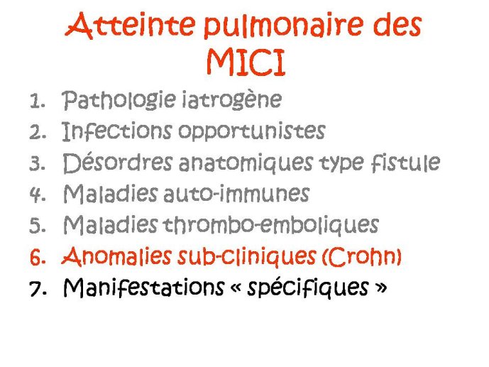 Diapositive6