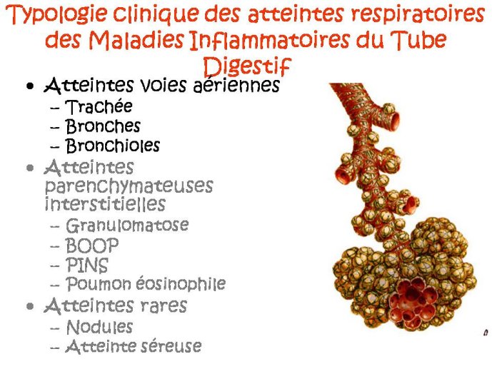 Diapositive11