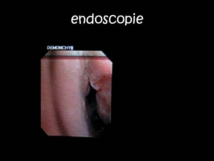 Diapositive20