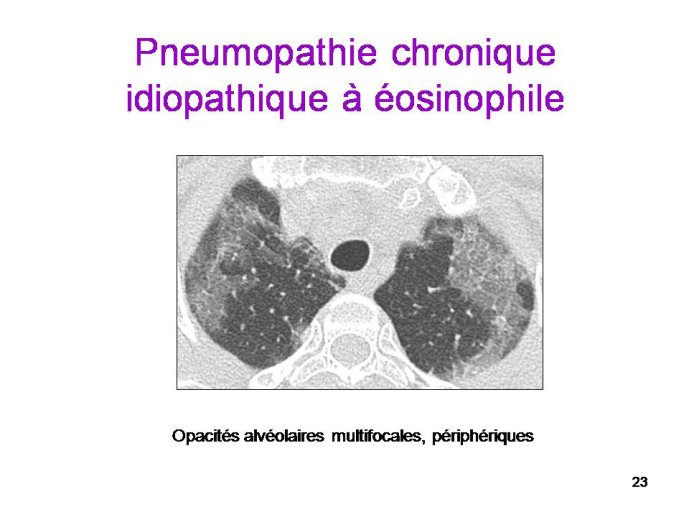 Diapositive23