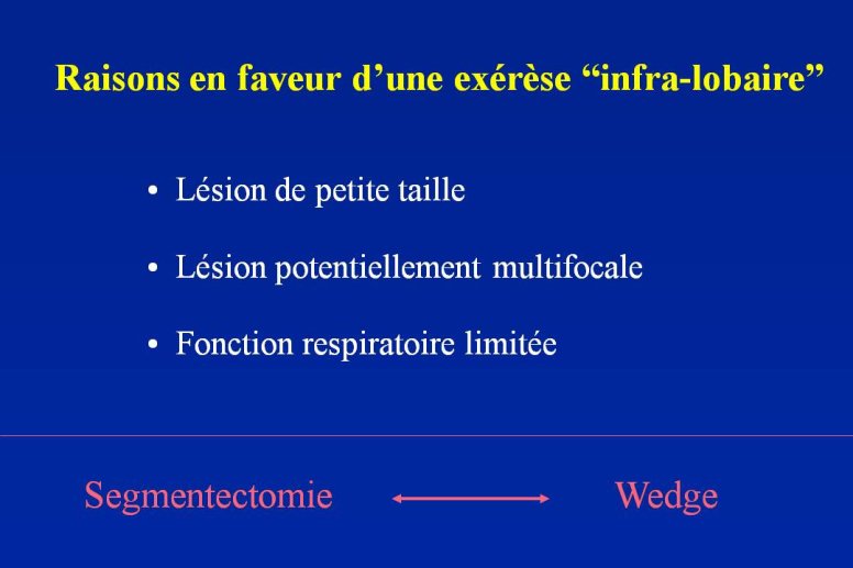 Diapositive8