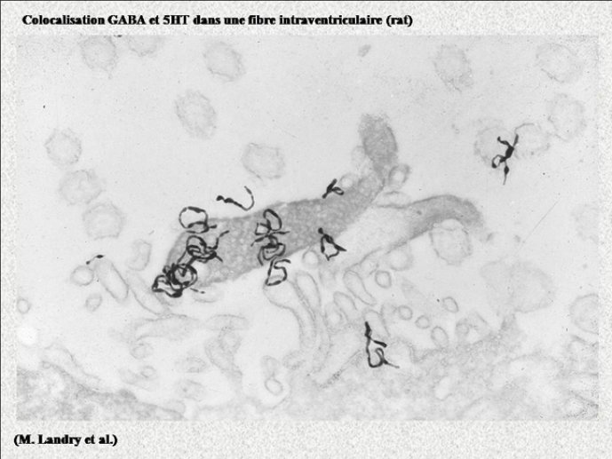 Diapositive22