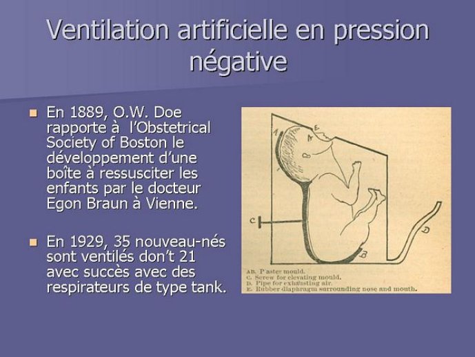 Diapositive30